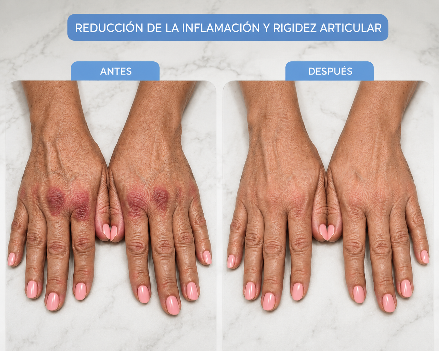 LevoraFlex™ Masajeador de Manos Profesional